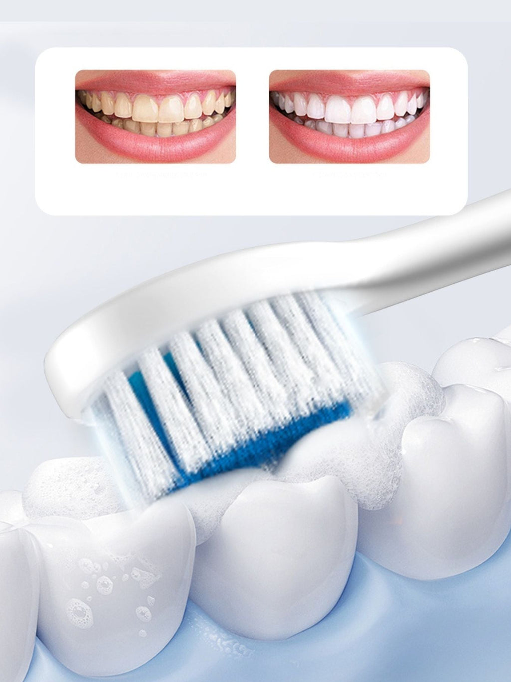 Multi-Speed Electric Toothbrush