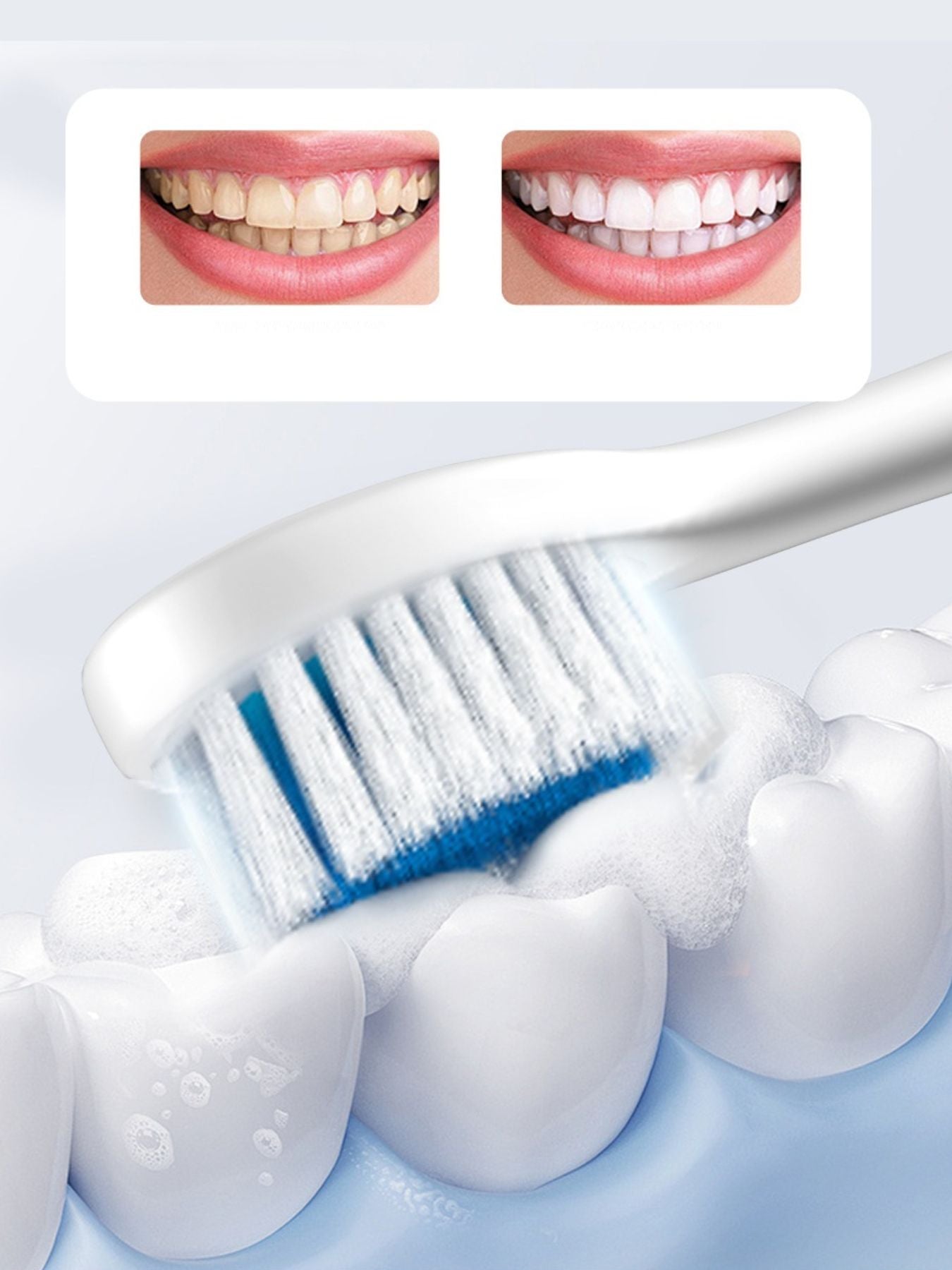 Multi-Speed Electric Toothbrush