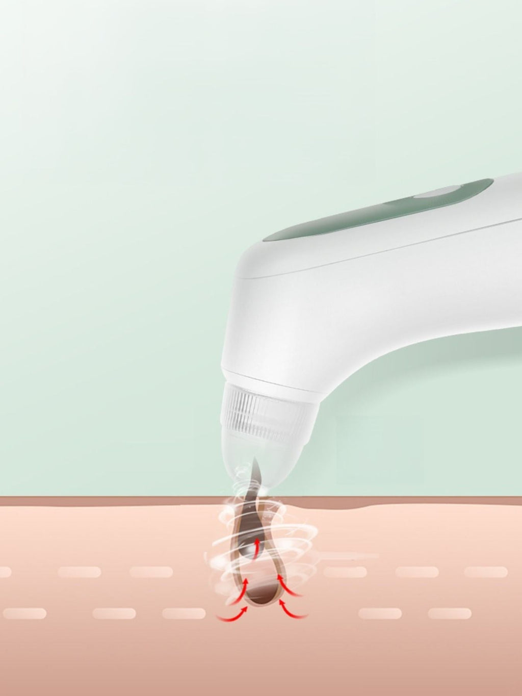 Painless Pore Vacuum Blackhead Extractor