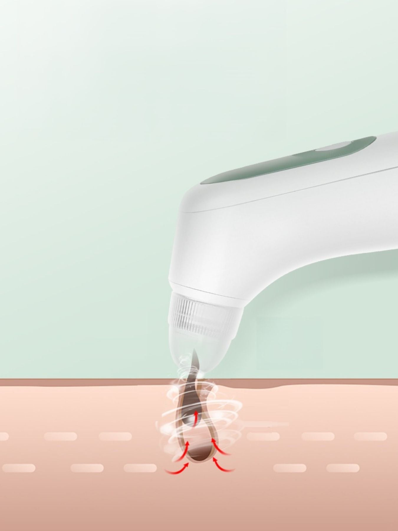 Painless Pore Vacuum Blackhead Extractor